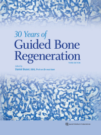 30 Years of Guided Bone Regeneration (3rd Edition) - Orginal Pdf